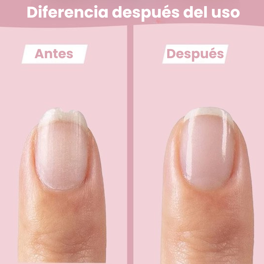 SafeCare – Silencioso y seguro: set eléctrico para limar las uñas del bebé