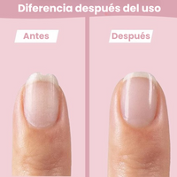 Thumbnail for SafeCare – Silencioso y seguro: set eléctrico para limar las uñas del bebé